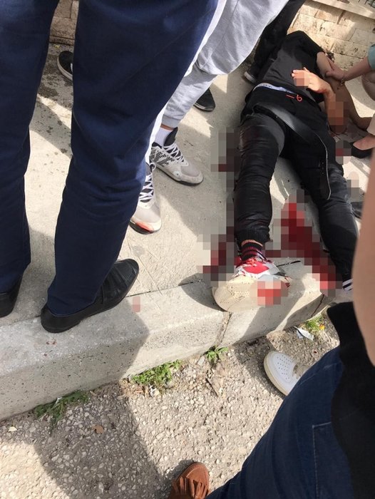 Okul önü kavgası kanlı bitti! 14 yaşındaki çocuk defalarca bıçaklandı