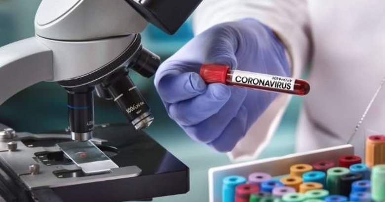 Bugünkü vaka tablosu belli oldu