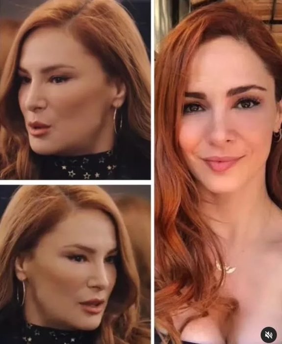 Mine Tugay’ın yüzüne ne oldu? Sosyal medya çalkalandı