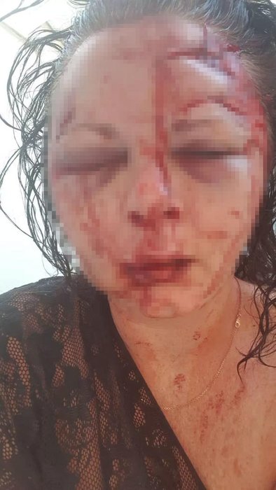 Marmaris’te saldırıya uğrayan turist kadın konuştu