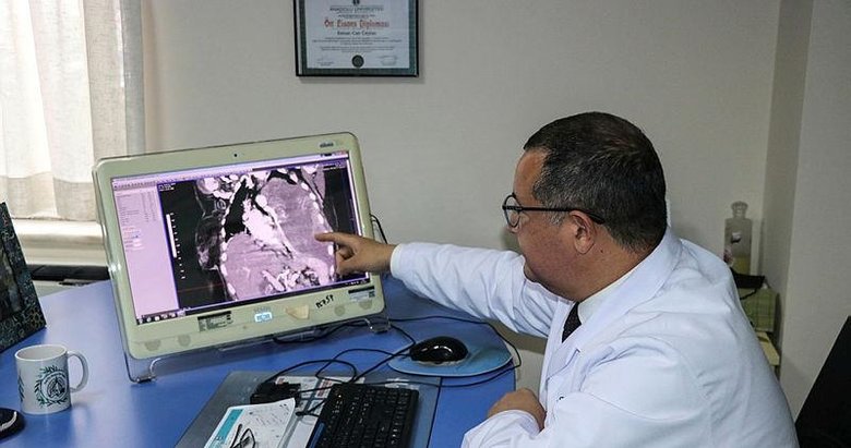 İzmir’de nefes darlığı çeken hastanın göğüs kafesinden 3 kilogram tümör çıktı