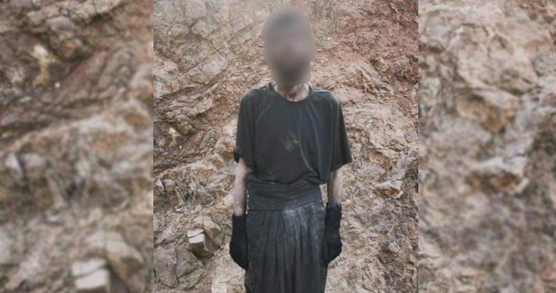 PKK’lı teröristler sefalet içinde: Açlıktan bağırsakları delinmiş