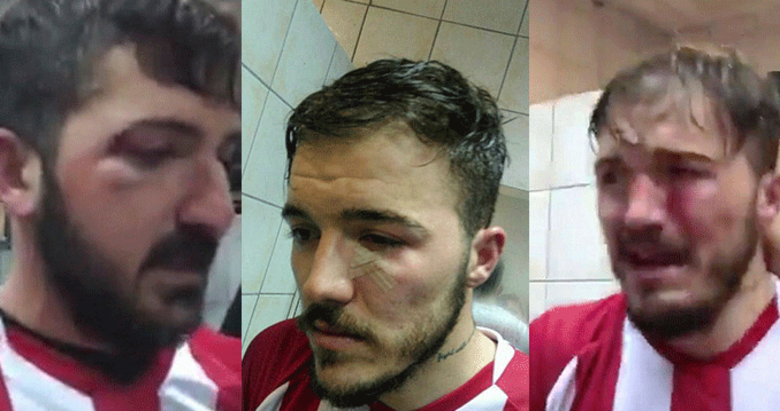 Yeni Çanspor’a İstanbul deplasmanında saldırı