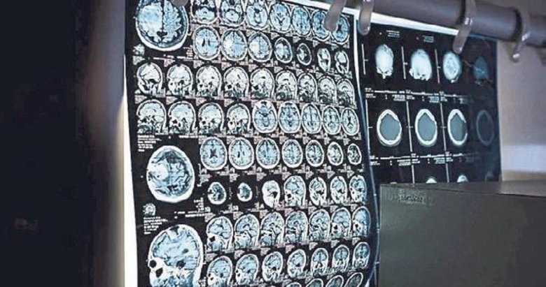 Bakanlıktan ‘Kanserde erken teşhis’ mesajı