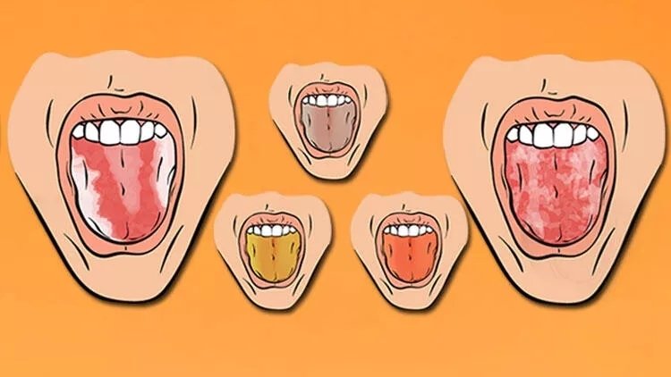 Dilinizin rengini bilin sağlığınızın ön kontrolünü yapın!