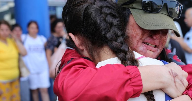 Kezzap saldırısına uğrayan Berfin Özek ameliyat olmak için Bodrum’a gitti