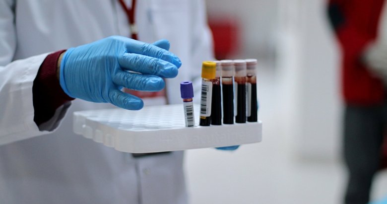 Bilim Kurulu üyesinden kan grubu uyarısı: O kan grubundakiler dikkat!