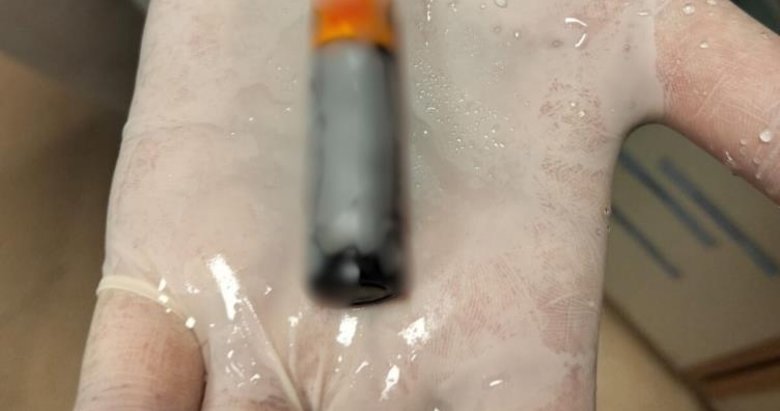 39 yaşındaki adam pil yuttu! Denizli’de şaşırtan olay