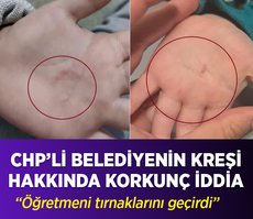 Bandırma Belediyesi’nin kreşinde 4 yaşındaki çocuğa öğretmeni tırnaklarını geçirdi iddiası