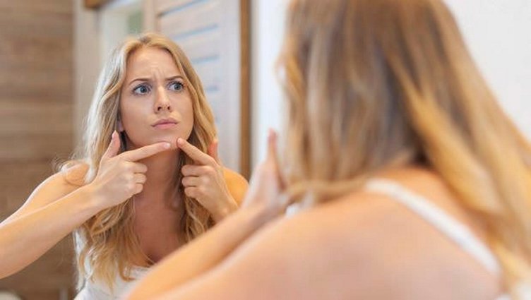 Sivilce nasıl geçer? Sivilce izi nasıl yok olur?