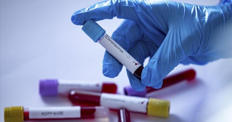 Son dakika: 23 Nisan koronavirüs tablosu açıklandı