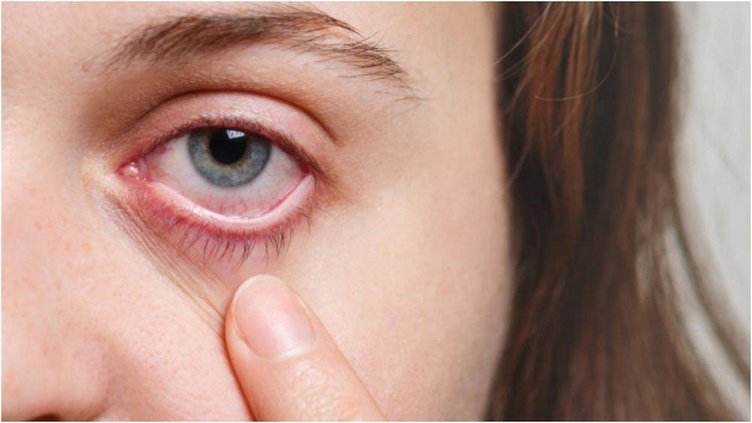 Enfeksiyonun beyne sıçramasına engel olmak amacıyla hastaların gözleri çıkarıldı! Kara mantar salgını nedir?