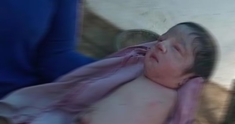 Hindistan’da kolları ve bacakları olmadan doğan bebek şaşkına çevirdi