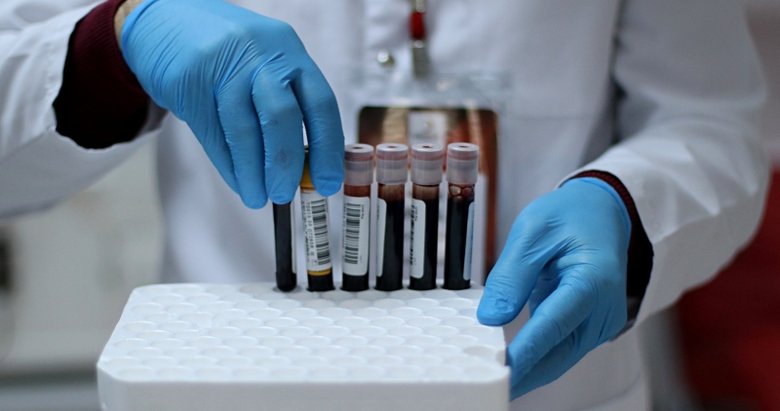 Bilim Kurulu Üyesi uyardı: Bu belirtilere dikkat!