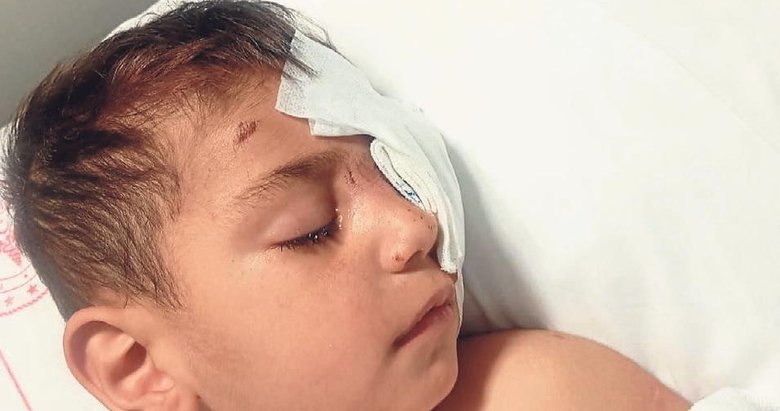 Köpek saldırısına uğrayan minik Yiğit’in durumu ağır