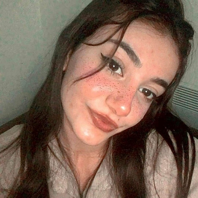 Bisikletten düşen Berfin hayata tutunamadı