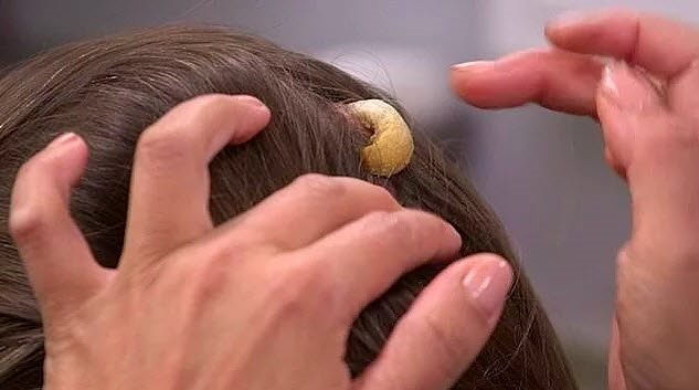 Bilim insanları şaşkın! Kafasında boynuz çıktı...