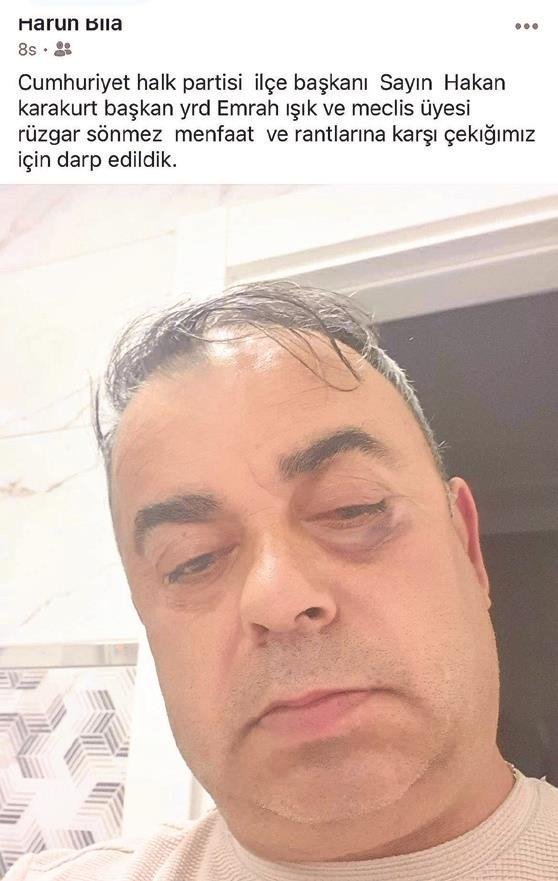 Sözde hizmet özde kavga