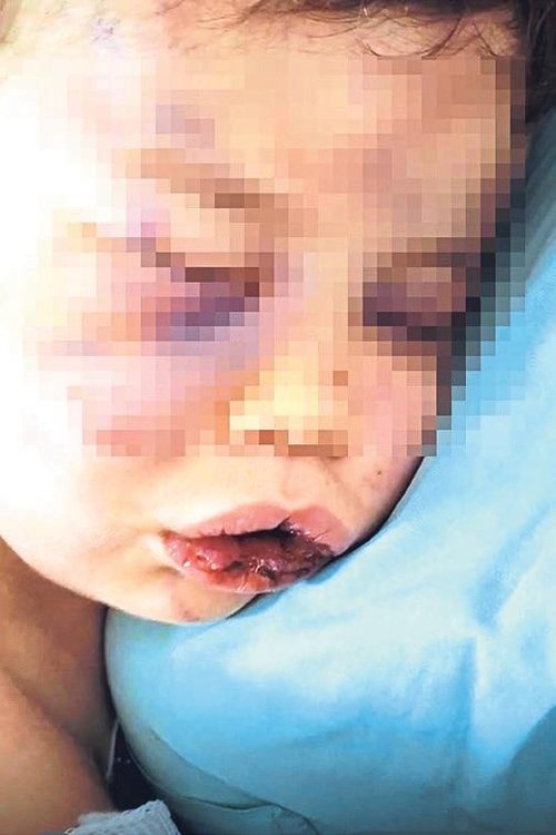 Minik bebeğe korkunç şiddet! Ellerin kırılsın