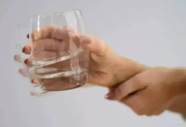 Saç kepeğini görmezden gelmeyin! O hastalığın habercisi...