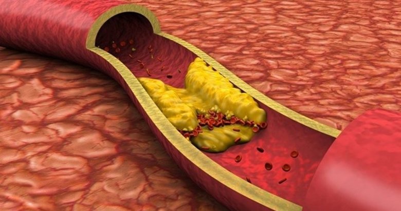 Kan pıhtılaşması nedir?
