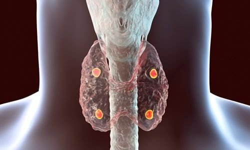 Nadir görülen hastalığın şifasını İzmir’de buldu