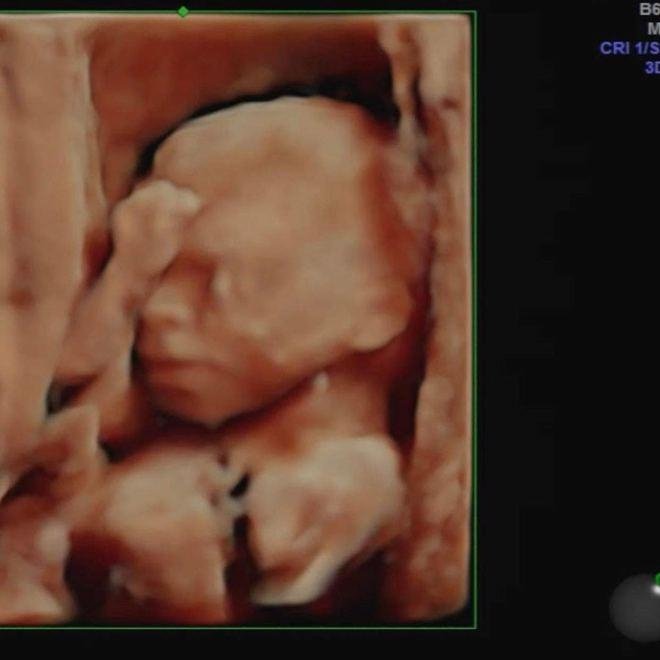 Aşkları sınır tanımamıştı! Anna ve Mürsel’den müjdeli haber geldi