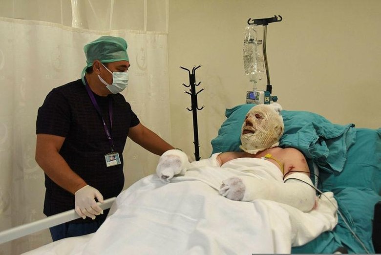 Yangınla savaşırken alevler arasında kaldı! Yaşadığı dehşet anlarını böyle anlattı