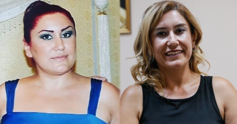 Estetik Ile Onceki Hallerinden Eser Kalmayan 13 Unlu Maya Estetik