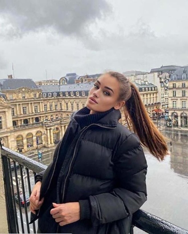 Ukraynalı mankenin ’darp’ iddiasına polisten soruşturma