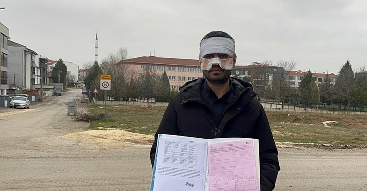 Eskişehir'de meslektaş şiddeti! Rehber öğretmen, fizik öğretmenini cayır cayır yaktı