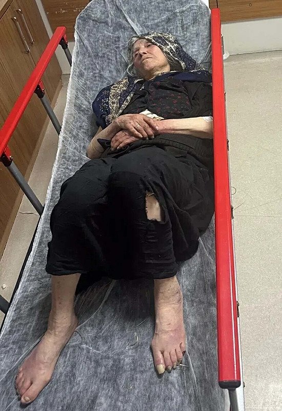 Kayıp Alzheimer hastası 3 gün sonra baygın bulundu