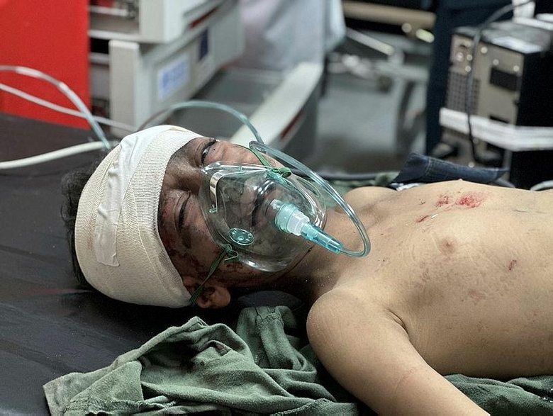 İsrail katliama devam ediyor! Gazze’de öldürülenlerin sayısı 10 bin 569’a yükseldi