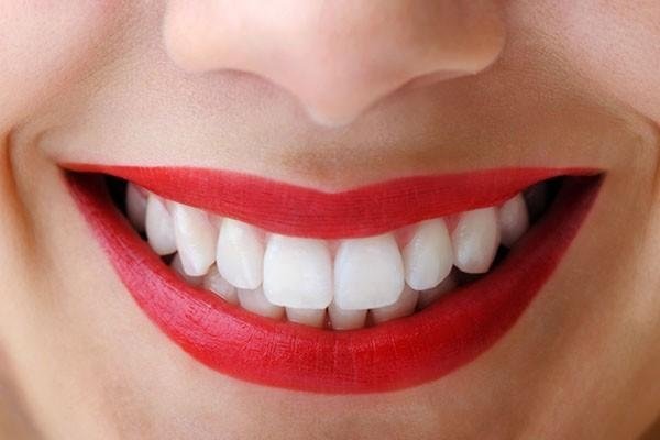 20 dakikada doğal yöntemlerle dişlerinizi bembeyaz yapabilirsiniz