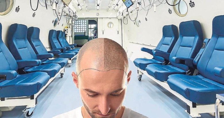 Saç ekiminde uygulanacak teknik, analiz sonrası belirlenir