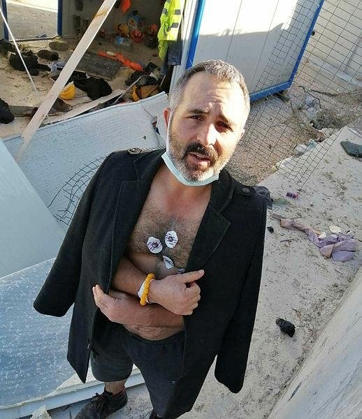 Hortumun yaraladığı işçiler konuştu: Hortum bizi alıp sürükledi