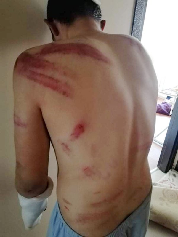 Afyonkarahisar’da balıkçı çırağını darbettikleri iddiasıyla 2 kişi gözaltına alındı