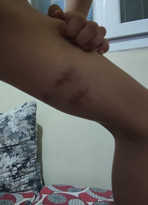 Bir pitbull dehşeti de İzmir’de! Sahibi tasmayı bırakınca saldırdı