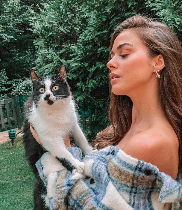 Estetik furyasına o da katıldı! Bensu Soral’ın son hali olay oldu