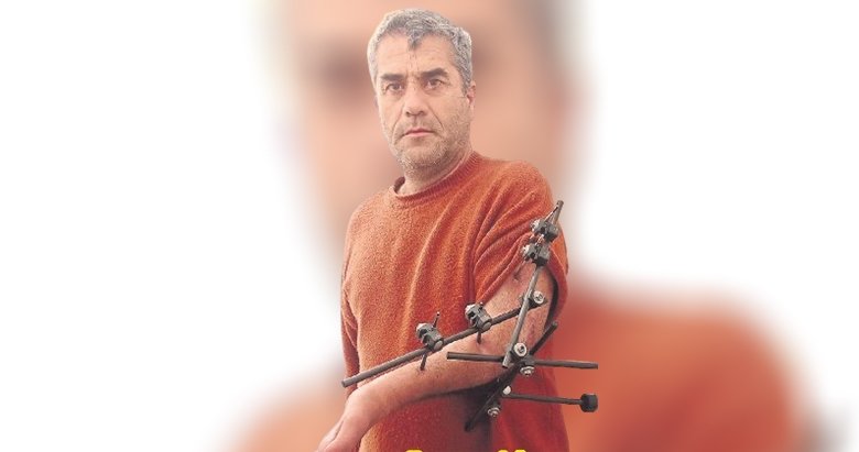 Kopuk kol davası