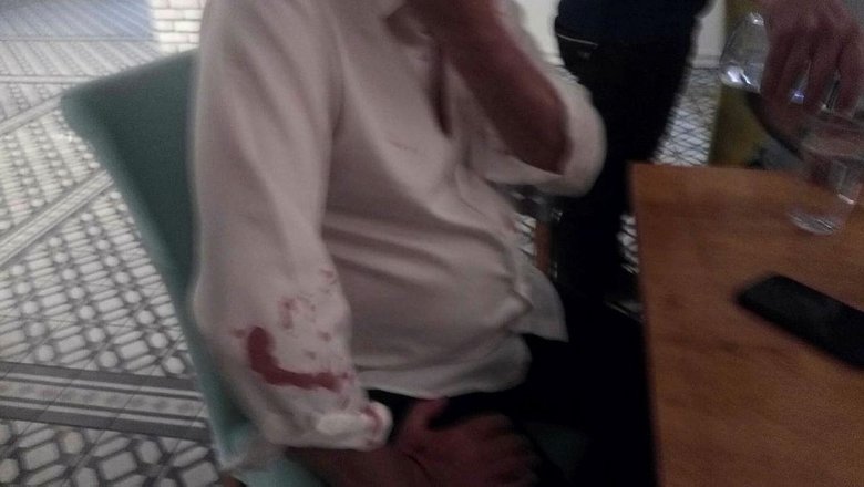 Atabay’dan açıklama geldi! CHP’li Didim Belediye Başkanı Atabay ve avukatı sopalı saldırıya uğramıştı