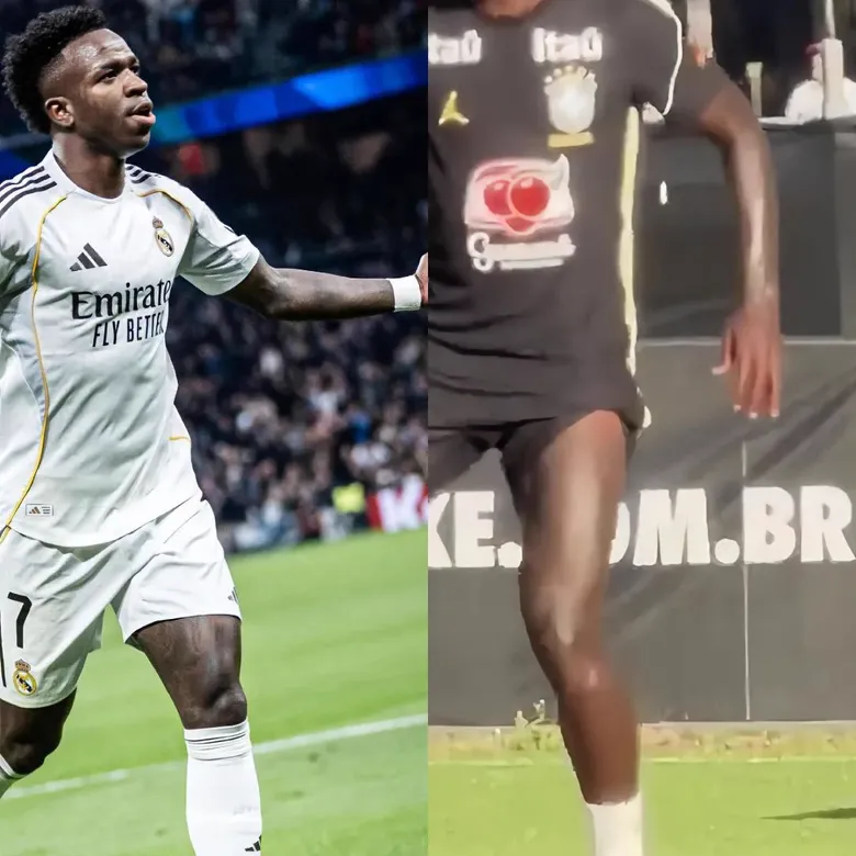 vinicius-junior-olduruldu-mu-dovmeleri-kayboldu-yuzu-degisti-yerine-baskasi-mi-gecti-1790760699221.png