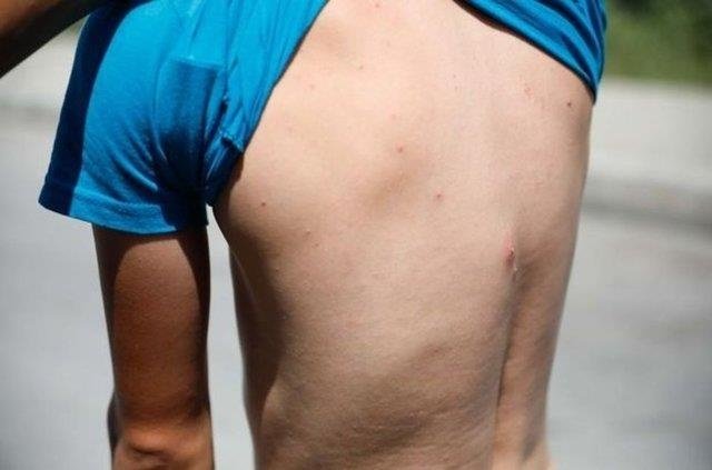 İzmir'de sivrisinek alarmı: Uzmanlar özellikle bu türe karşı hamileleri uyardı