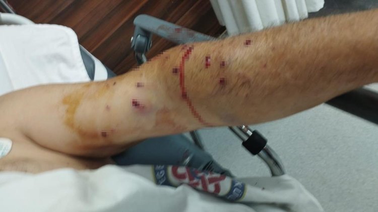 İzmir’de TIR sahibi 180 liralık kantar ücreti için çalışanı vurdu