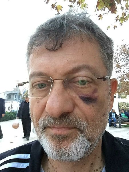İzmir Gaziemir’de doktora şiddet! Sağlık raporu vermedi diye kafa attı