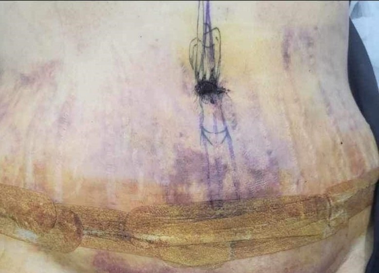 Yağ aldırmak için İzmir’e gelen İngiliz kadının hayatı karardı