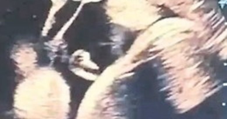 Anne karnındaki bebeğe doktoru kan verdi