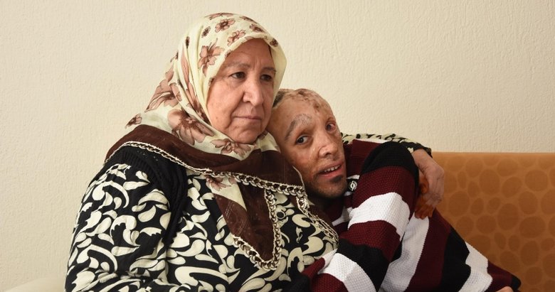 Izmir De Mehmet Ali Yi Ameliyat Edecek Doktorlar Araniyor Izmir Haberleri