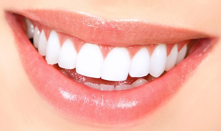 Bu yöntemle siz de bembeyaz dişlere sahip olabilirsiniz! İşte doğal yöntemlerle diş beyazlatma