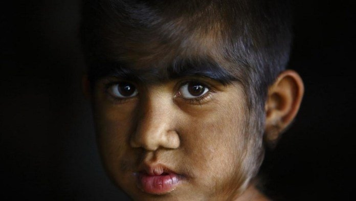 bebekken mide ilaci yerine verilen hap